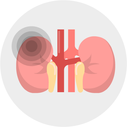 Icon of kidney damage